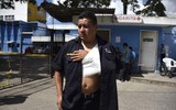 Những hình ảnh mới nhất về vụ xả súng tại Guatemala